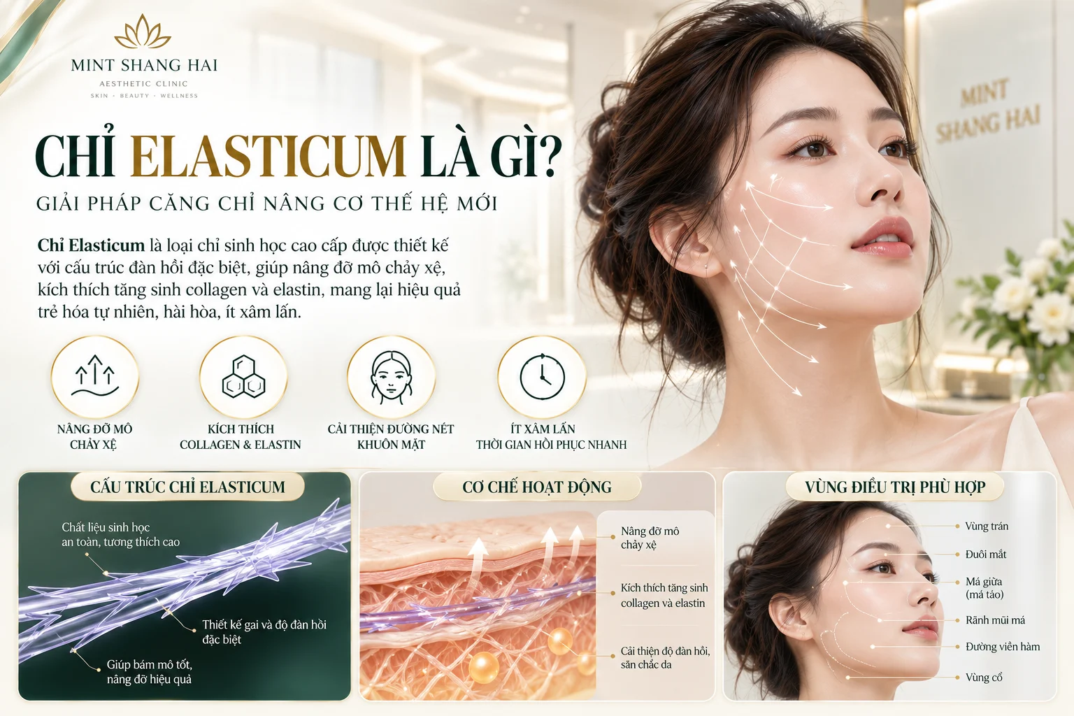 Chỉ Elasticum là gì: cấu tạo sản phẩm.