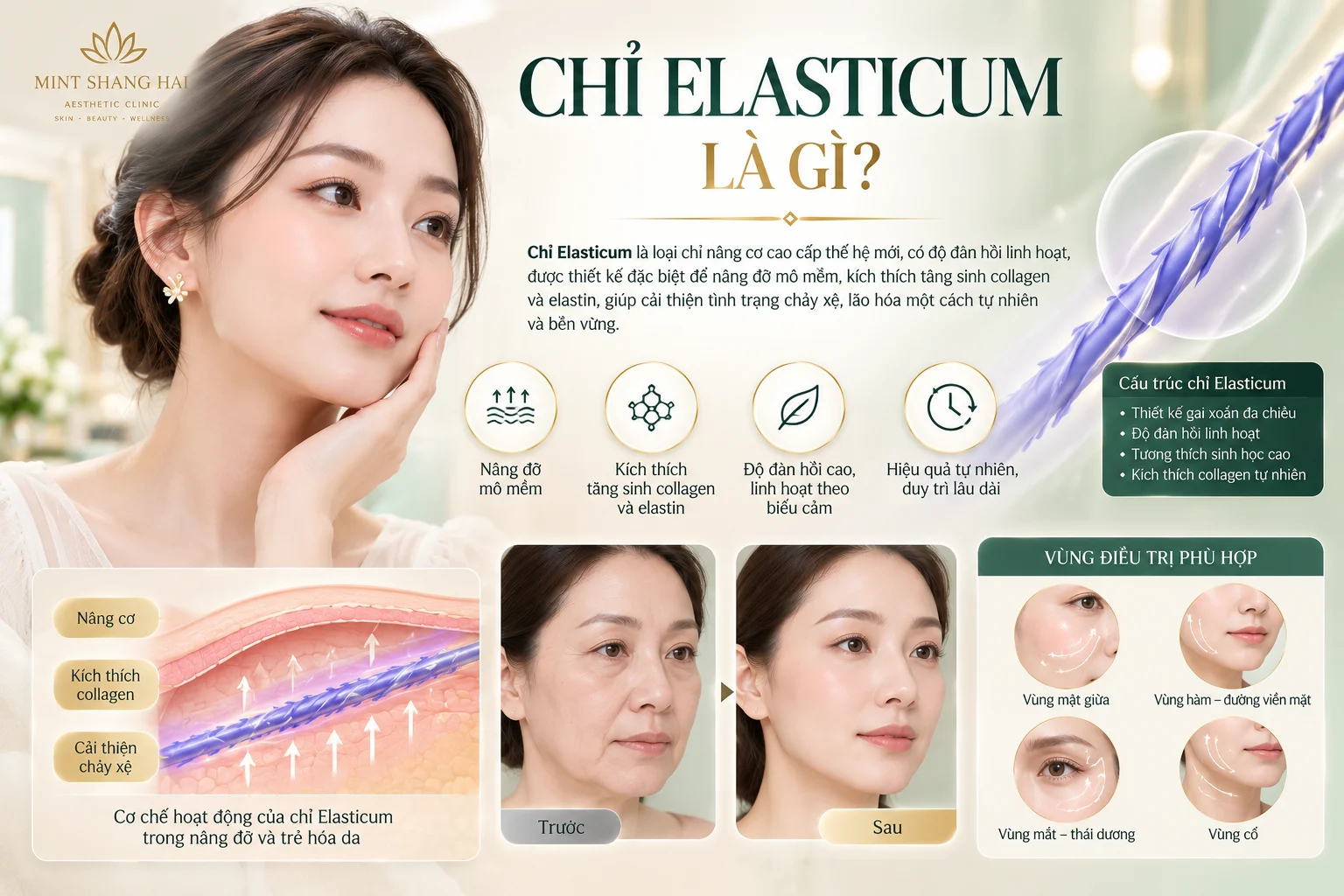 Chỉ Elasticum là gì? 21 điều cần biết 57 chỉ elasticum là gì - hình ảnh 5